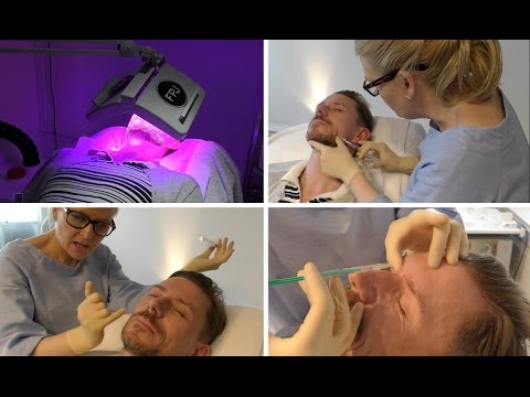 WATCH ME GET BOTOX! WATCH ME GET BOTOX!