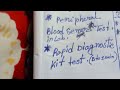 Maleria disease / ম্যালেরিয়া ## sing &amp; symptoms, prevention etc, all medical exam ✍🏻👩‍⚕️👍