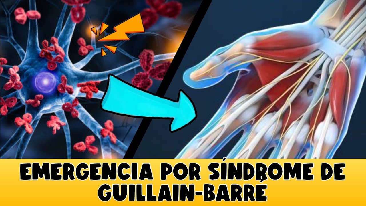 sindrome di guillain barrè contagio