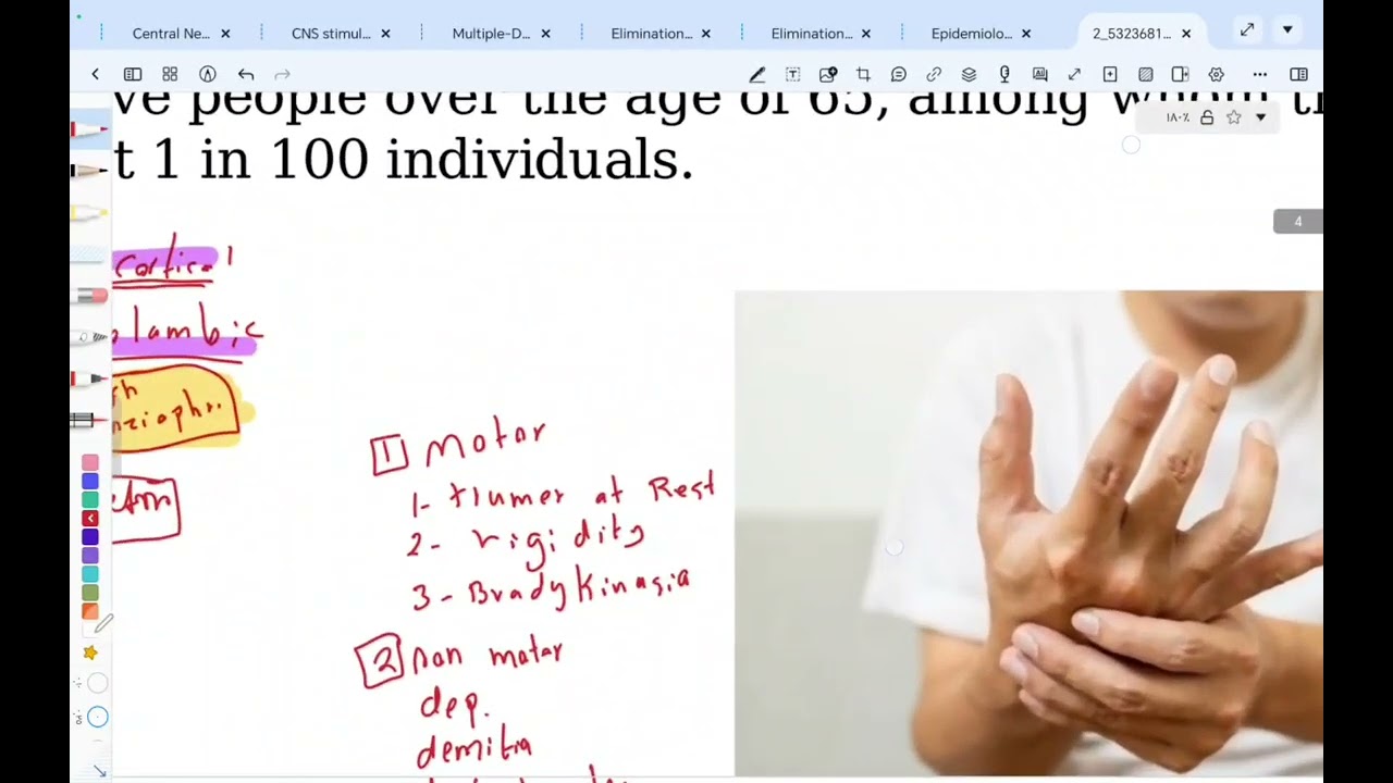 Neuro degenerative (Parkinsium / Alzheimer / MS / ALS) || د. ذو الفقار