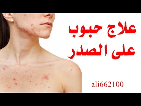 علاج حبوب على الصدر _ Get Rid of Chest Acne