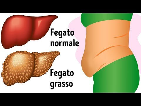 10 avvisaglie che indicano che il tuo fegato è pieno di tossine