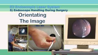 5 - Handling the Endoscopes