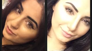MY NOSE JOB EXPERIENCE AND VLOG | ZHILABEAUTY