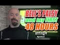 Bell's Palsy and my First 48 hours: The Important Facts