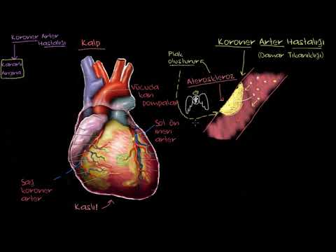 Koroner Arter Hastalığı Nedir? (Fen Bilimleri) (Sağlık ve Tıp)