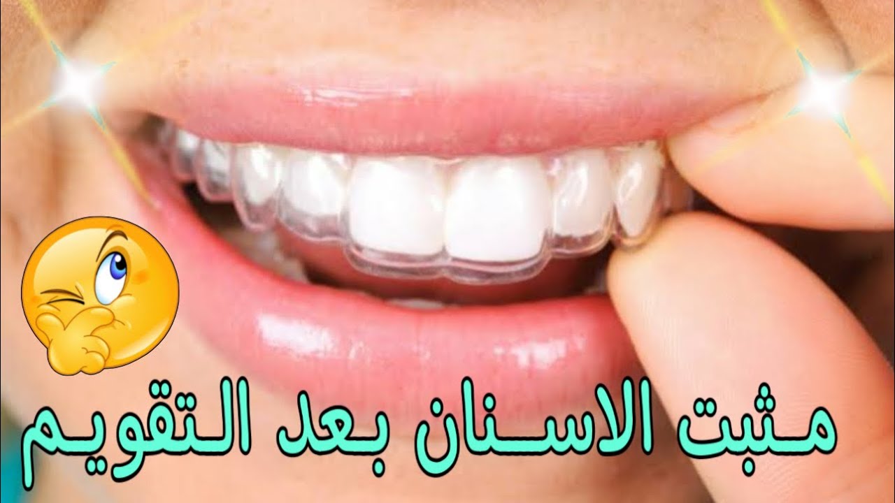 البطل أستلم مثبت التقويم | تعليمات هامه 🚨