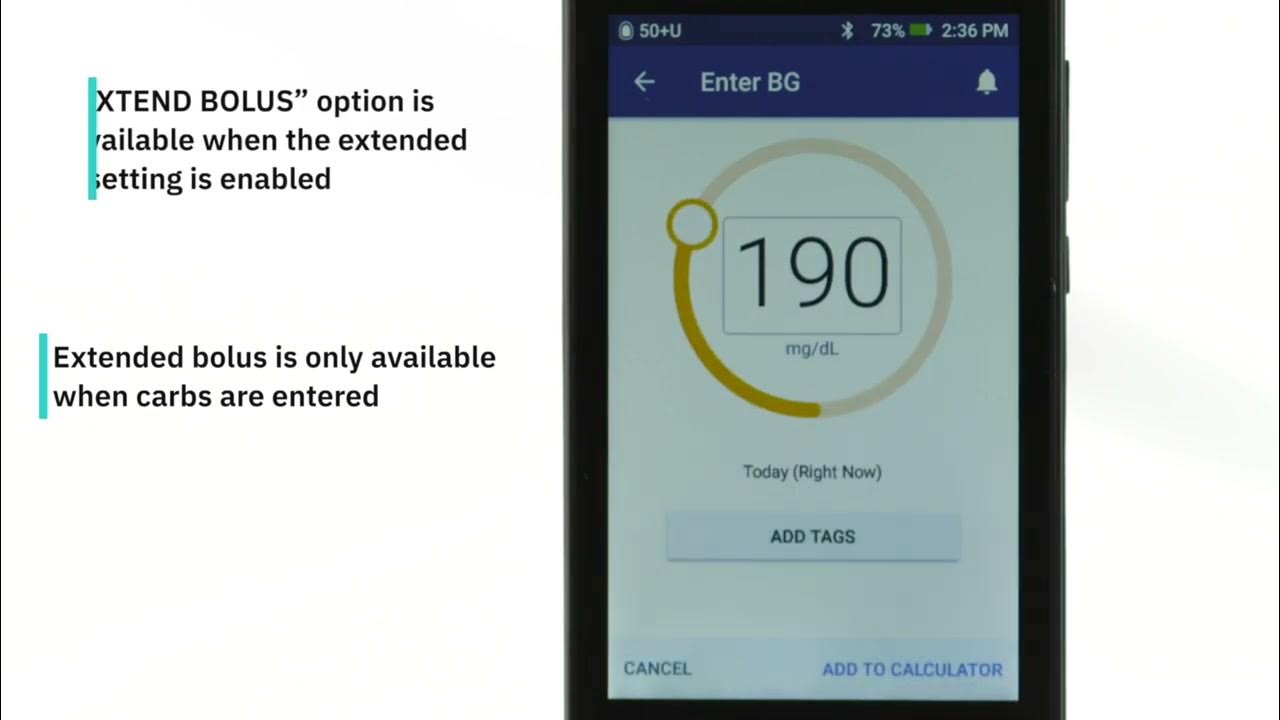 Omnipod DASH® How to Deliver an Extended Bolus YouTube