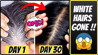 30 Days Challenge: Reverse White/Grey hair naturally | White to Black hair