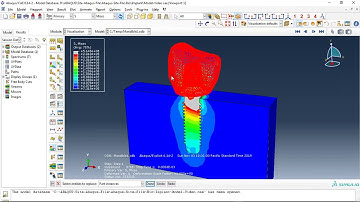 Simulation dental implant in interaction with mandible bone under dynamic load in Abaqus
