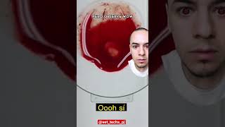 Dióxido De Cloro Sangr3 Nico Sastré