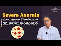 Severe Anemia Treatment That Actually Works | Patient Testimonial