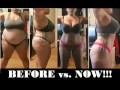 1 Year Post VSG!!! | Before and Now Pics | Saggy Skin
