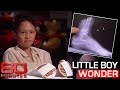 How a horrific freak accident left a little boy with no hands and feet | 60 Minutes Australia