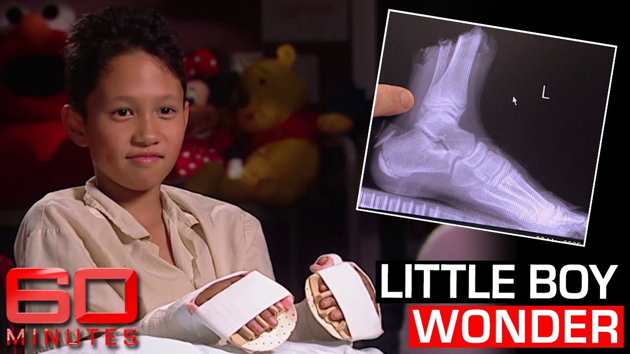 How a horrific freak accident left a little boy with no hands and feet | 60 Minutes Australia