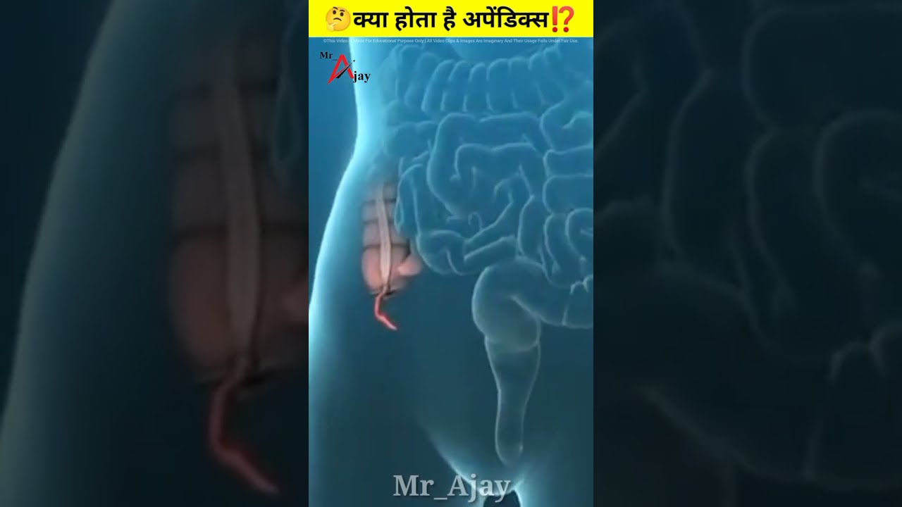 क्या होता है अपेंडिक्स ?शरीर में इसकी ज़रूरत क्या है?