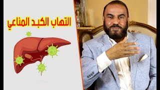 اسرع علاج منزلي لعلاج التهاب الكبد المناعي