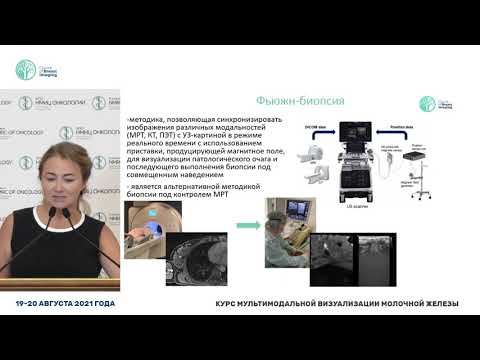 Фьюжн-биопсия образований молочных желез,относящихся к категории BI-RADS 4 и BI-RADS 5 по данным МРТ