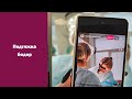 Феморопластика (подтяжка внутренней поверхности бедер)
