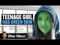 GIRL Has GREEN SKIN! | Dhar Mann Studios Mp3 Song