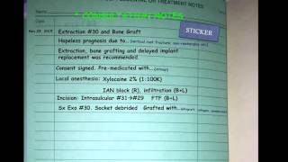 How to write surgical notes