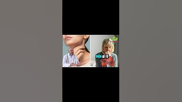 Đờm và chất nhầy dai dẳng: Nguyên nhân ít ai ngờ và bí quyết khắc phục tự nhiên