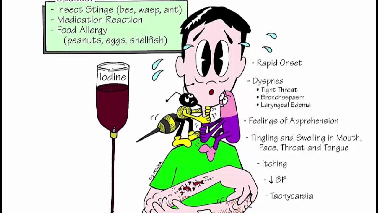 Respiratory Review - Critical Care 
