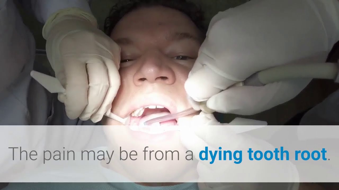 cosmetic dentistry Queens Flushing (718) 9891985 Dental Plate