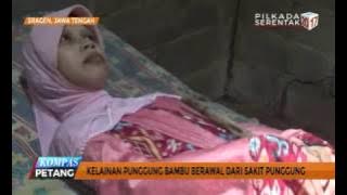 Sulami, Kisah Mengharukan 'Manusia Kayu' Asal Sragen