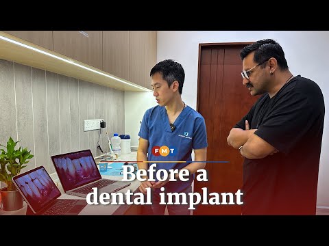 What really happens before a dental implant