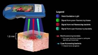 NATROX Wound Care Module 4: The Role of Diagnostic Imaging 2 0