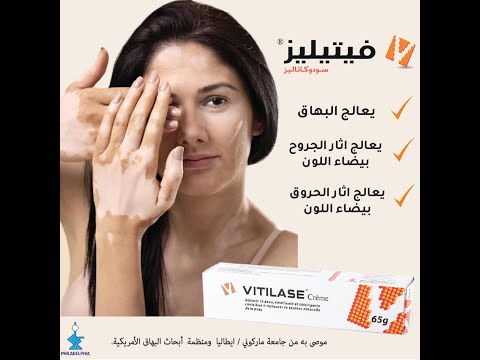 فيتليز كريم لعلاج البهاق