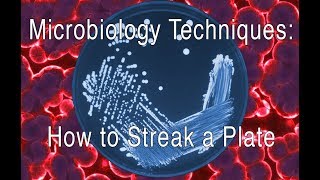 How to Streak a Bacterial Plate