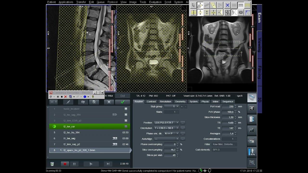 mri-lumbar-spine-complete-procedure-positioning-protocol-filming-in