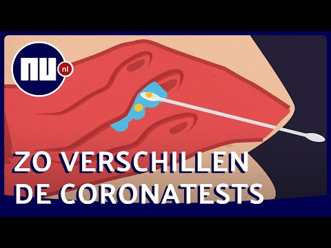 Zo verschilt de coronatest voor thuis en evenementen met de GGD-test | NU.nl