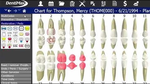 Clinical Charting & Note Click Through  DentiMax 18 Features1