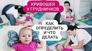 КРИВОШЕЯ у грудничков /Как определить кривошею у ребенка и что делать!04.2021 г.