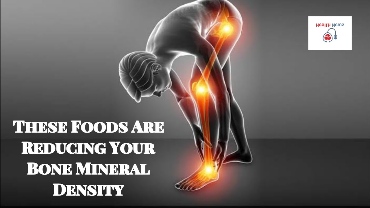 These Foods Are Reducing Your Bone Mineral Density - YouTube