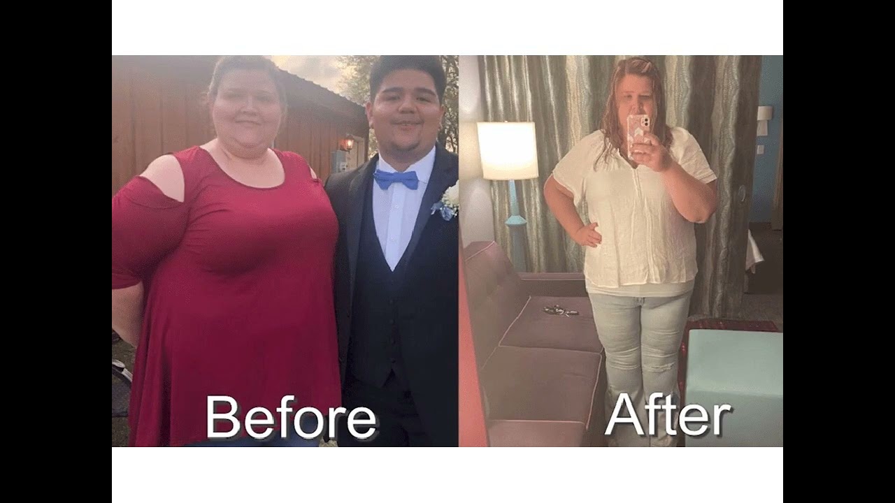 Laser Me: Aesthetics & Wellness | Medical Weight Loss in ST. Louis, MO