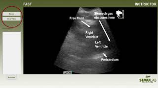 Sonoskin Ultrasound Diagnostic Trainer For Fast Efast