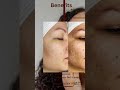 Introducing OhR Radiance Pro-Pigment Perfector with Thiamidol | Tailored Skincare Solutions #shorts