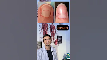 🖐🏻О наличии каких заболеваний могут говорить ногти | Как оценить состояние организма