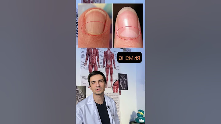 🖐🏻О наличии каких заболеваний могут говорить ногти | Как оценить состояние организма