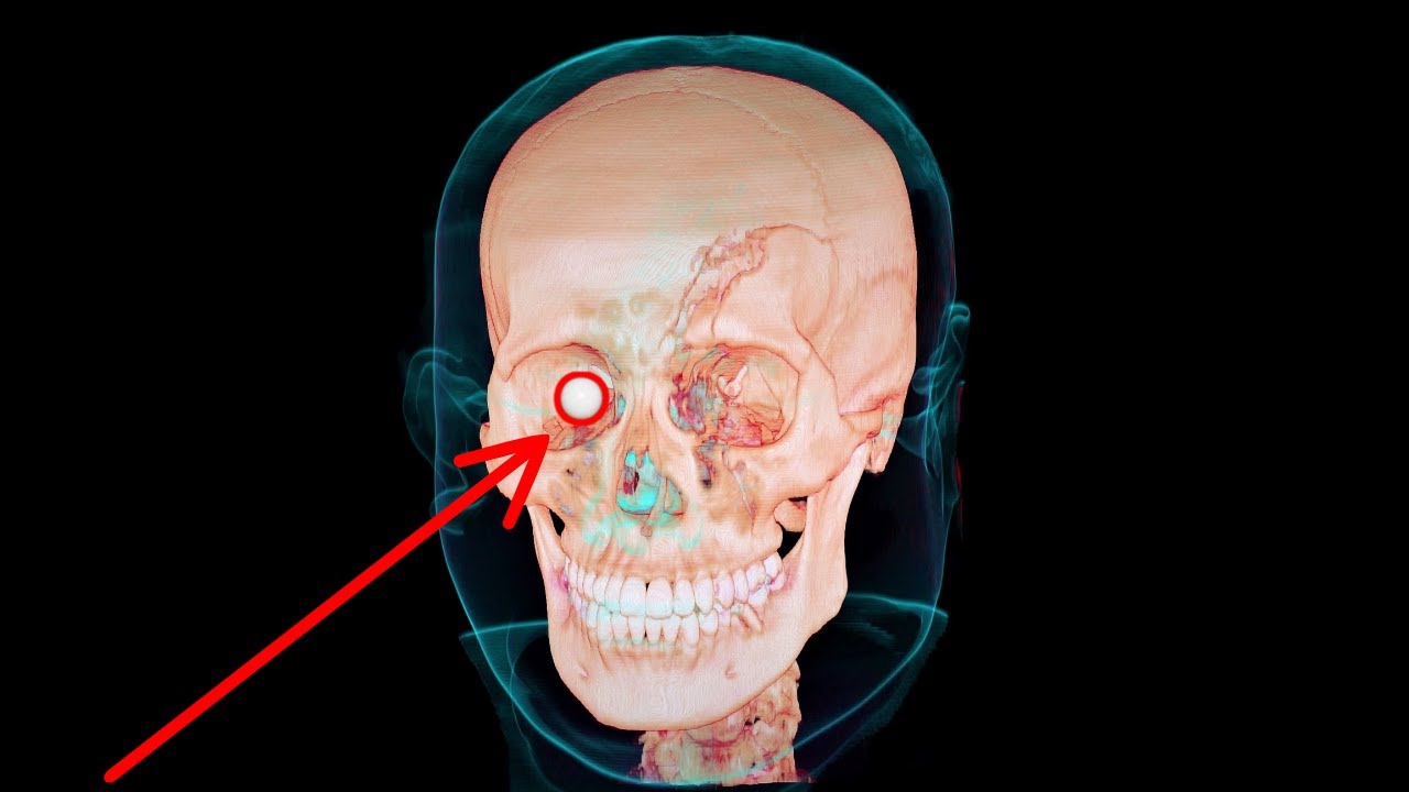 OPERADOR QUASE PERDE OLHO? ⚠️ | GAMEPLAY AIRSOFT