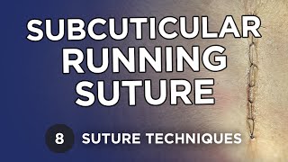 Subcuticular Running Suture - Learn Suture Techniques