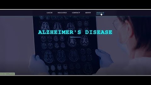 Alzheimer Disease Detection Using LLM