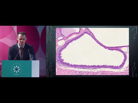 Концепция интраэпителиальных неоплазий молочной железы