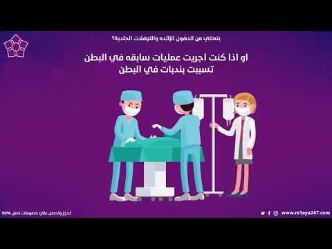 احجز عملية شد البطن بعد العمليات بخصم 30% مع رعاية 24/7