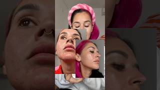 Adding This Into My Skincare Has Been Game Changing