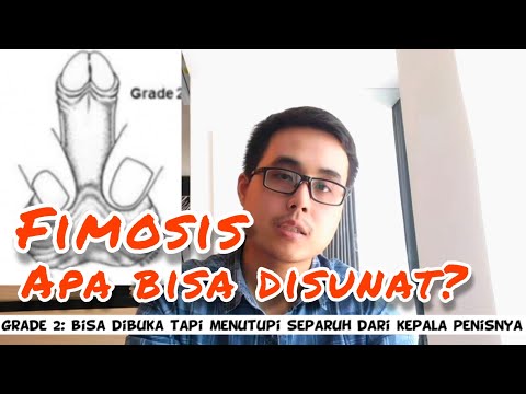 Video: Adhesi Penis: Jembatan Kulit, Pada Dewasa, Tidak Disunat